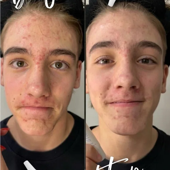 Quick fix - Picture 9 of 12